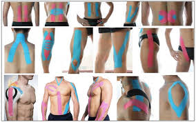 Who Should Use Tape? | ProActive Physical Therapy