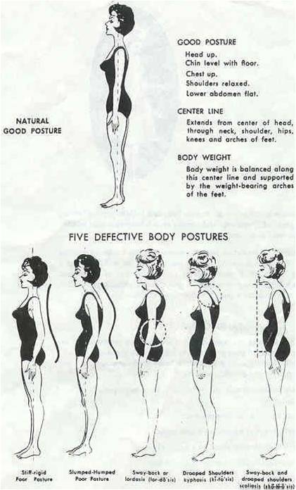 good and bad posture
