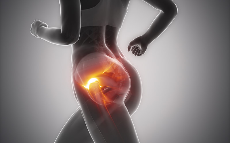 Bursitis Hip Injury Inflammation