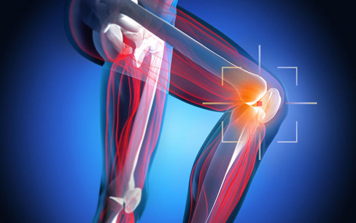 Medial Patellofemoral Ligament Anatomy