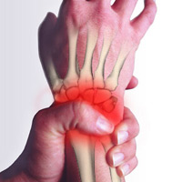 Is It Tendonitis Or Tendinitis Proactive Physical Therapy